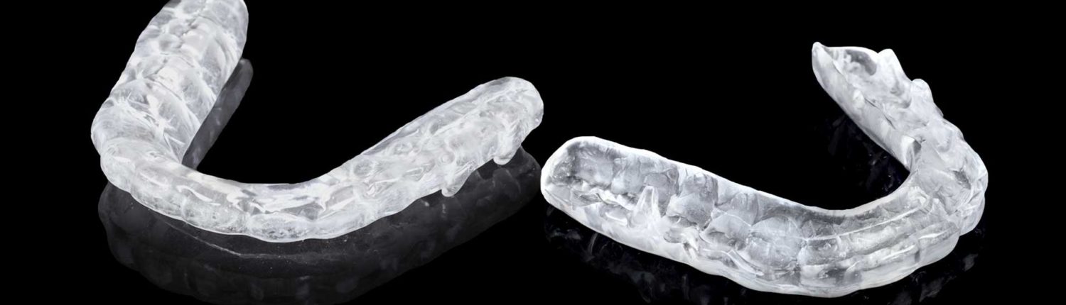 Férulas de descarga Férulas de descarga explicado - Dr. Reato